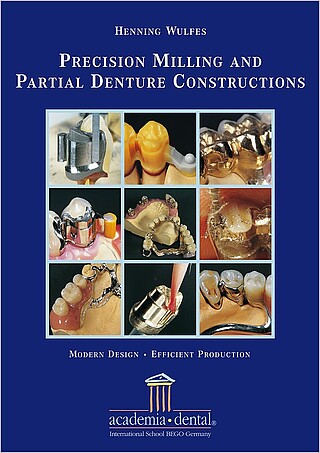 Precision Milling and Partial Denture Constructions – Modern Design and Efficient Production