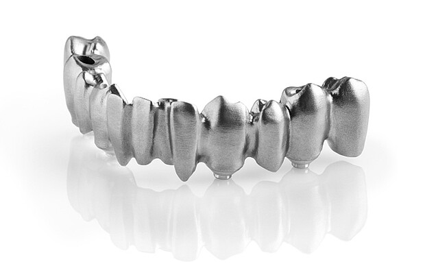 CAD/CAM occlusally screw-retained bridge