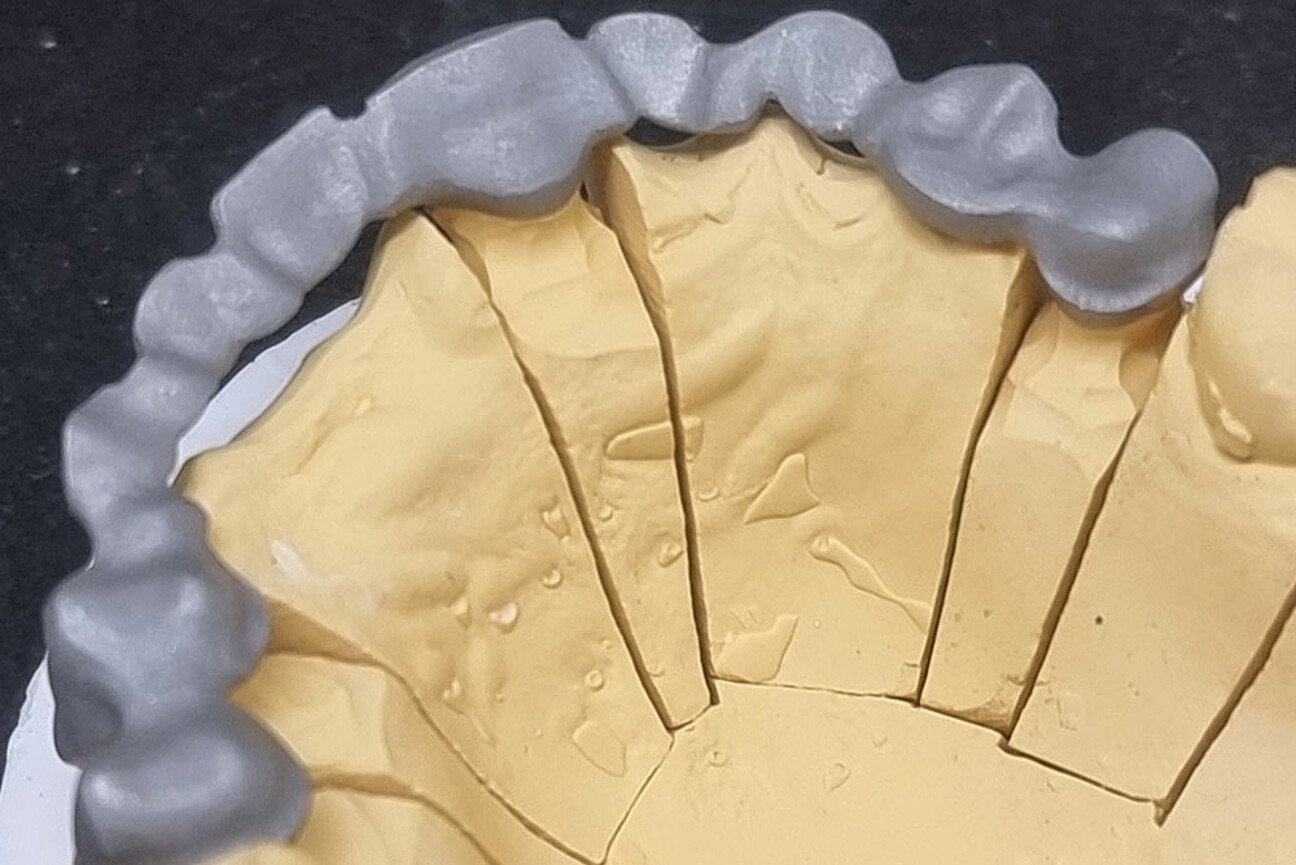 std_1K_SmartVeneering_Model-1