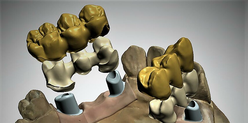 content-img_1K_Filesplitting