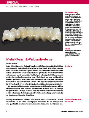 PD Dr. R. Strietzel | Metall-Keramik-Verbundsysteme