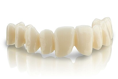 BEGO Zirkon ST – Supertransluzentes Zirkoniumdioxid für großspannige Restaurationen