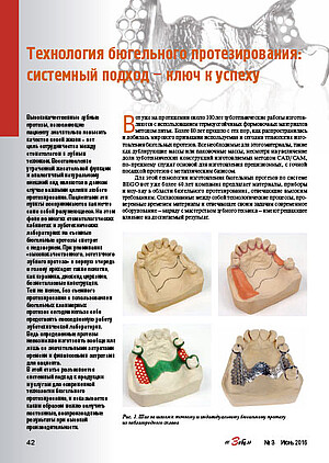 Investment materials for model casting in the dental laboratory