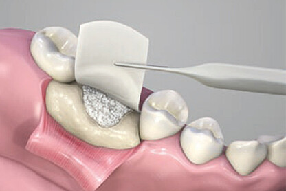 BIS_naturesQues_ColTect-P_PosteriorFigureC_HiRes_V2