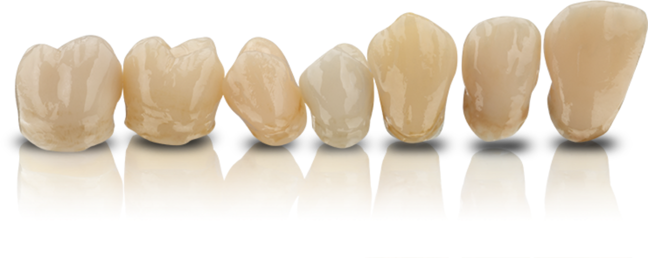 VarseoSmile-Crown-plus-7-Kronen