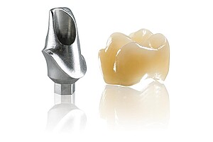 Individuelle Abutments auf Basis der Implantatplanung