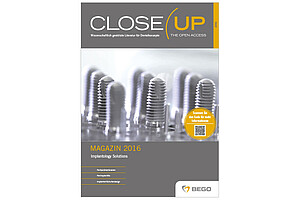 Ab sofort ist das erste Close Up Magazin 2016 erhältlich und kann kostenfrei bei BEGO Implant Systems bezogen werden