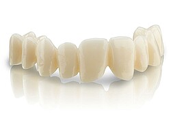 BEGO Zirkon ST /BEGO Zirkon ST Multi – Supertransluzentes Zirkoniumdioxid für großspannige Restaurationen