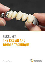 Guidelines – The Crown and Bridge Technique