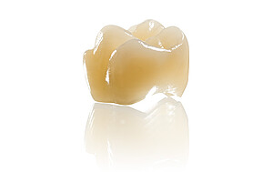 A single crown produced with BEGO PMMA Multicolor.
