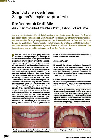 Eine Partnerschaft für alle Fälle – die Zusammenarbeit zwischen Praxis, Labor und Industrie | ZA Till Does, ZTM Olaf Stanzel