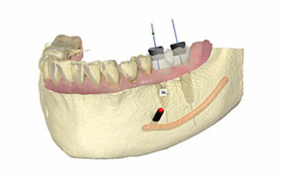 nav_chirurgie_planungszentrum_320
