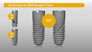 Die BEGO Semados® S-Line 1993 - 2017