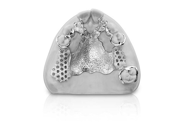 Mediloy® RPD partial denture frameworks for upper jaw – polished and blasted