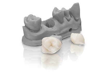 VarseoSmile Crown plus – The tooth-colored, ceramic filled hybrid material for 3D printing of permanent single crowns, inlays, onlays and veneers 