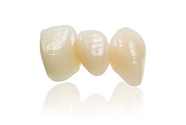 Bridge made of IPS e.max CAD