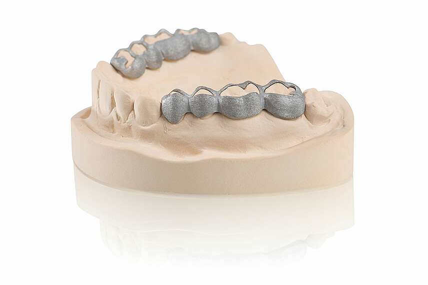 Orthodondic appliances– SLM produced