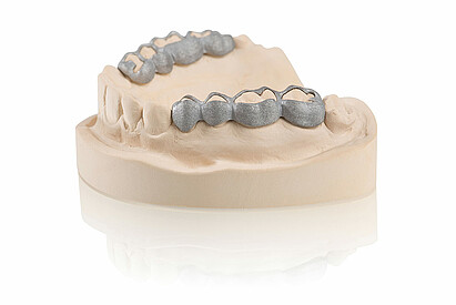 Orthodondic appliances– SLM produced