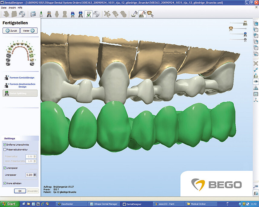 3_shape_12_Gliedrige_Bruecke_800_04