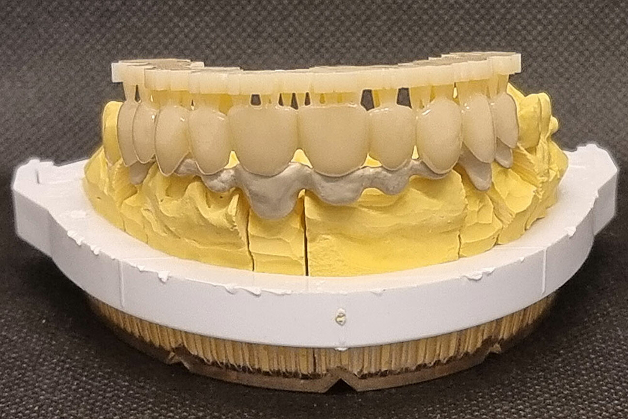 std_1K_SmartVeneering_Model-2