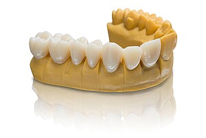 3D printed restorations made of VarseoSmile Temp are suitable for temporary use in the anterior and posterior region as short- and long-term restorations.