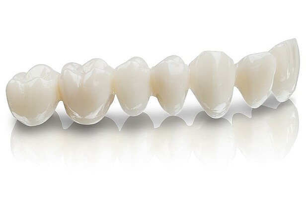 VSTQ_std-img_1K_02_VarseoSmileTemp-Bruecke