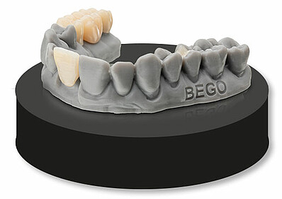 VarseoSmile® TriniQ®ist ideal für die Herstellung von Einzelzahnrestaurationen, es vereint hohe Materialstabilität mit guten ästhetischen Restaurationen, deren Preis Ihres Gleichen suchen