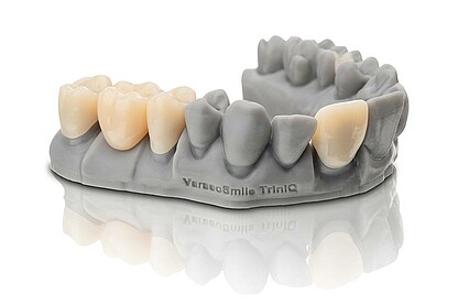 The high strength of VarseoSmile® TriniQ® enables the reliable fabrication of permanent three-unit bridges
