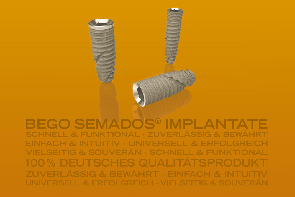 BEGO Semados® RS/RSX Implantate – Passend für zahlreiche Indikationen in der dentalen Implantologie