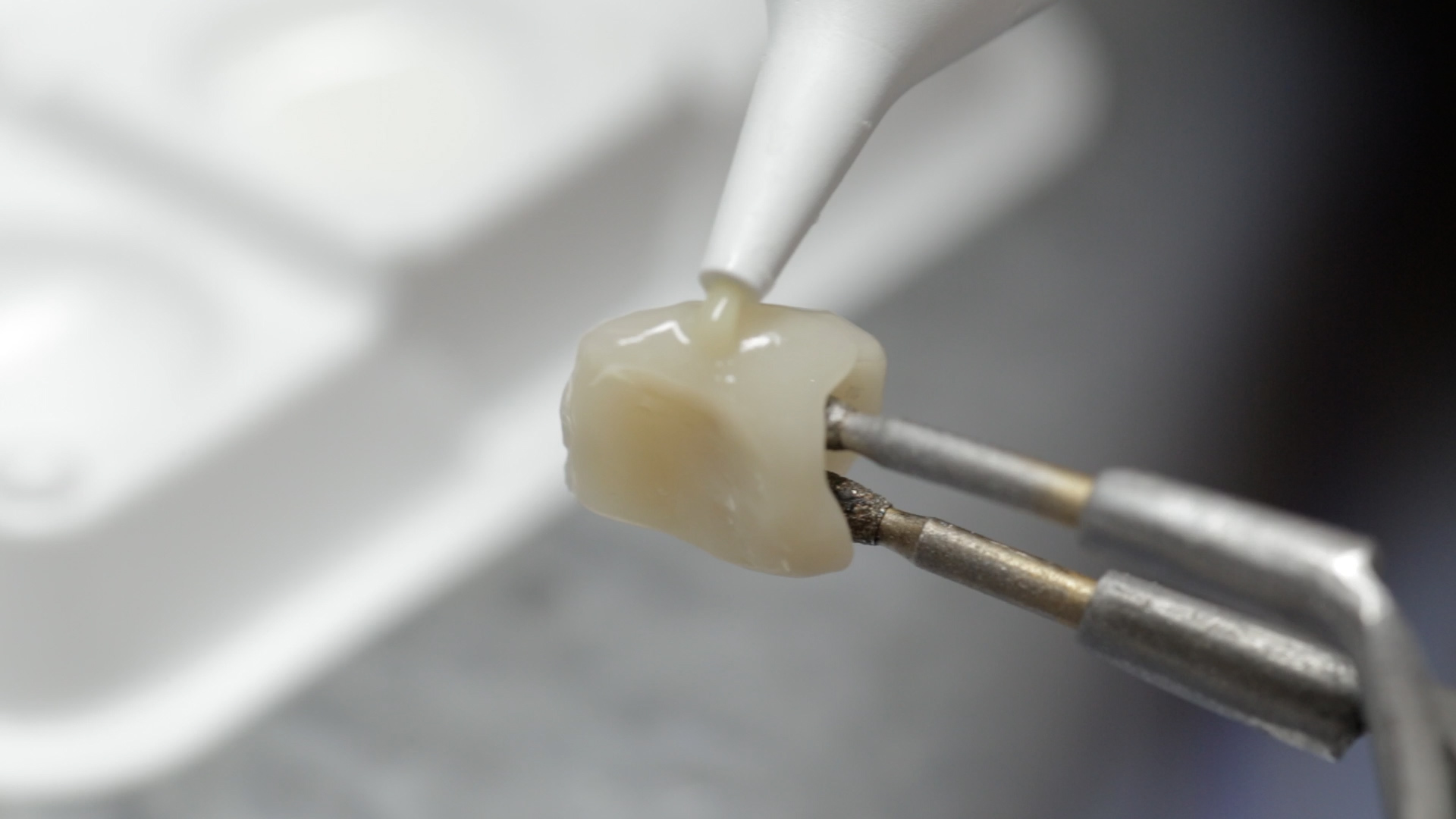 Supplementation with veneering composites